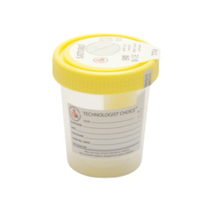 Mf Lab – Urine Container Yellow