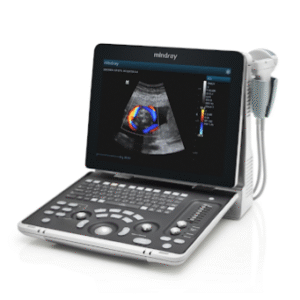 UltraSound Z 50 with Convex and TVS probe