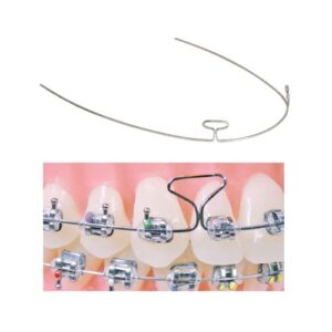 Anterior Stainless Steel Keyhole | 2-Loop | Right Form