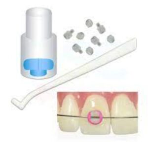 Bracket Bonder Tips And Handle