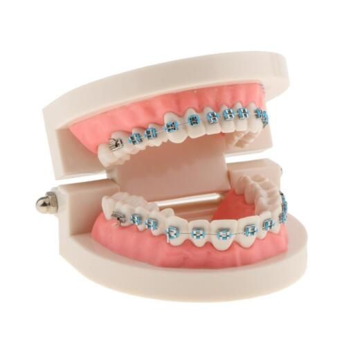 Bracketed Typodant Conlin Light Wire 5×5