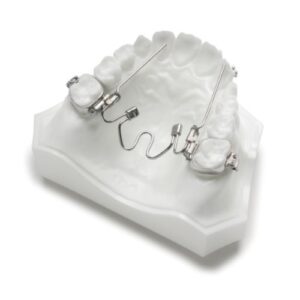 Niti Palatal Expander