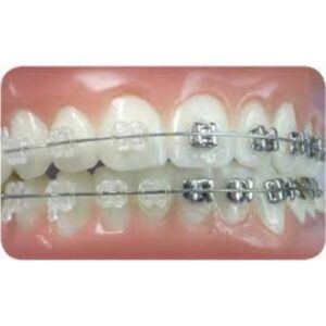 UL/LR Conlin Light Wire Composite Brackets Central Lateral