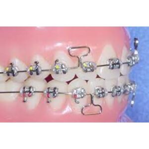 UL/LR Conlin Light Wire Composite Brackets Cuspid Bicuspid