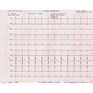Telepaper Malaysia – ECG Paper Bionet Cardiocare 2000/3000 ( With Graph) (CSO)